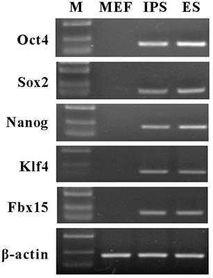 Induced Pluripotent Stem Cells Inhibit Bleomycin-Induced Pulmonary Fibrosis in Mice through Suppressing TGF-β1/Smad-Mediated Epithelial to Mesenchymal Transition